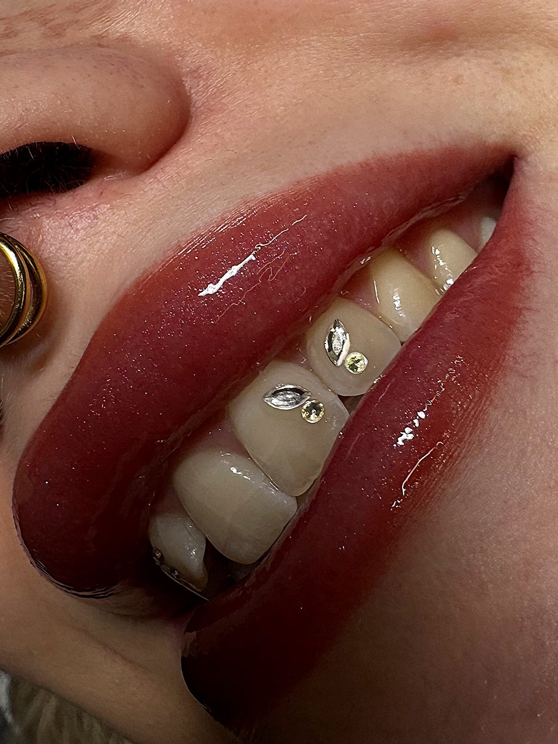 Applicazione di una gemma dentale sullo smalto nello studio Le Tatuarti Beauty di Pordenone