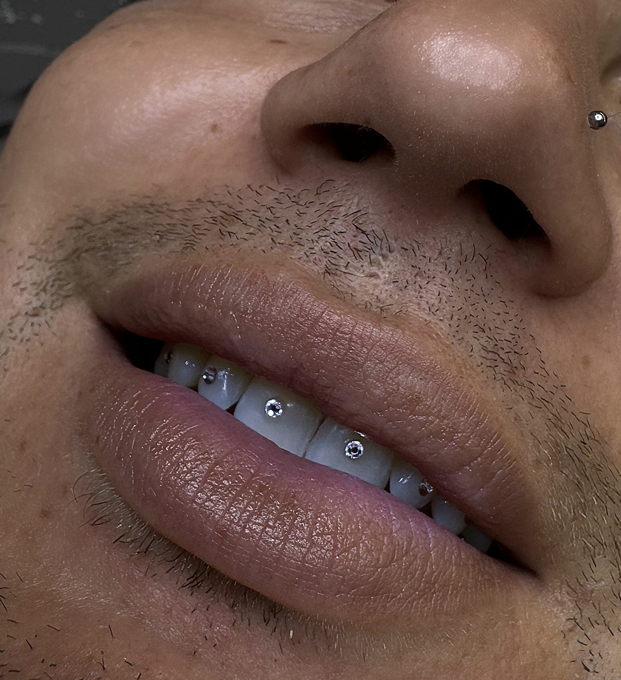 Sorriso con gemme dentali applicate, primo piano